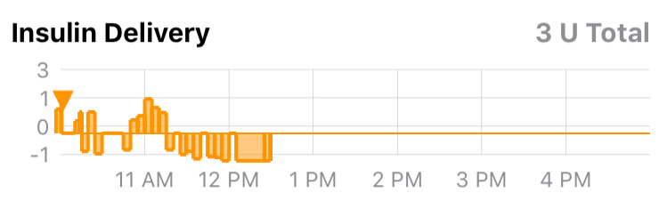 Plot of insulin delivery shown as bolus triangles and relative temp basal settings